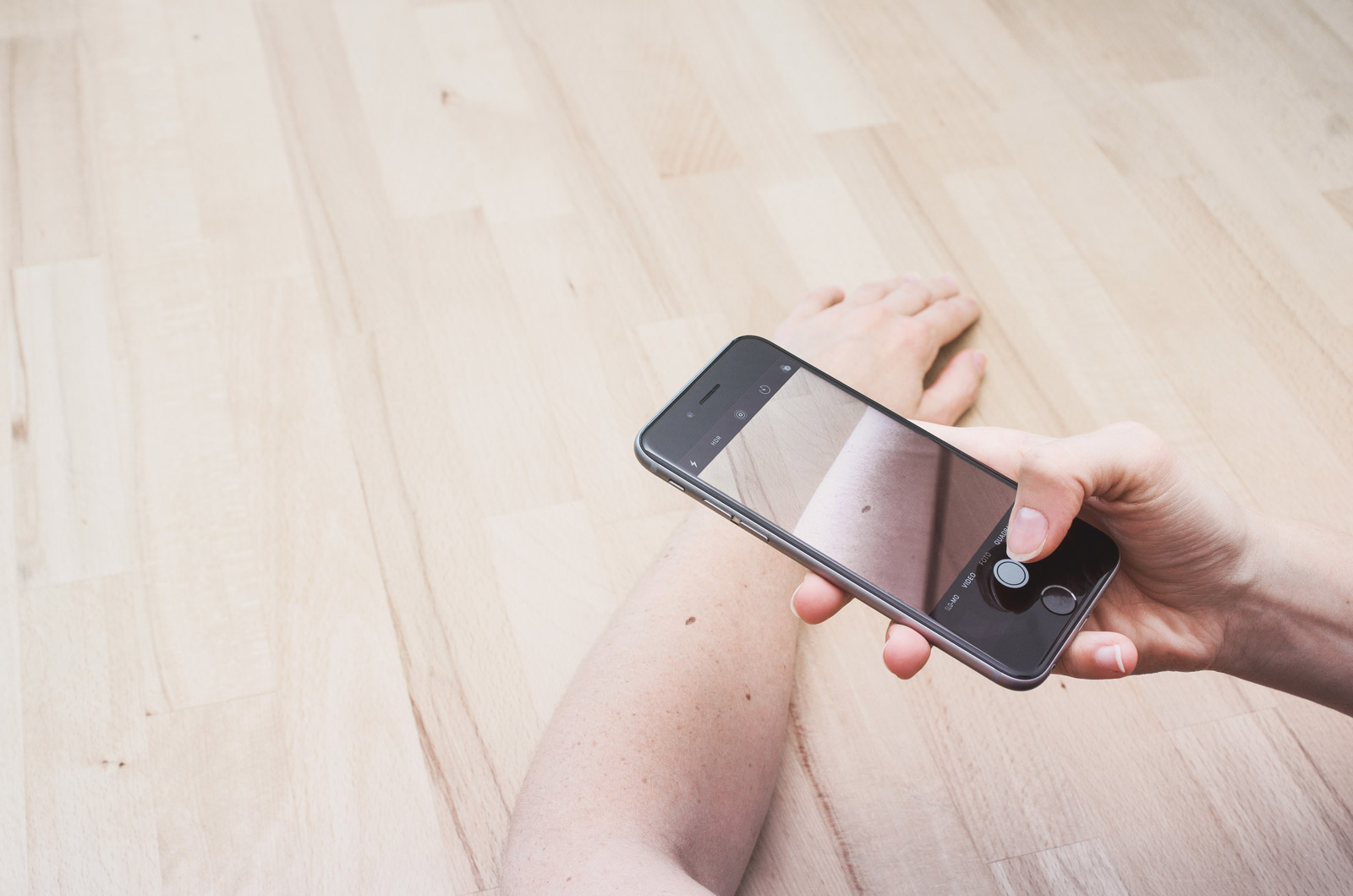 Patient fotografiert eine Hautveränderung am Bein mit dem Smartphone